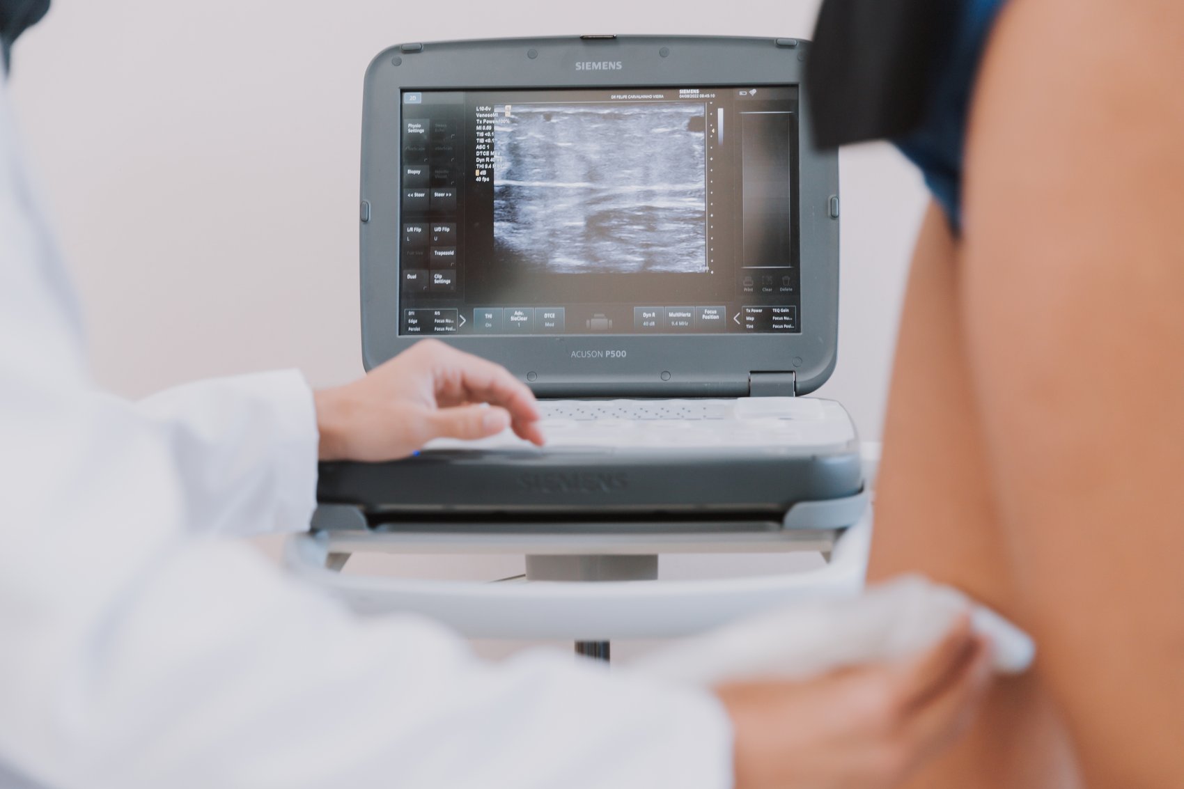 Dr. Felipe realizando avaliação com ultrassom Doppler vascular